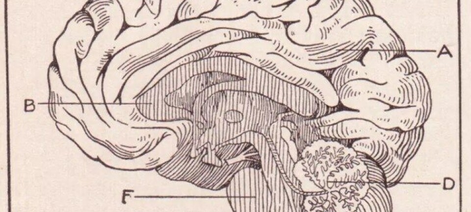 LES OGSÅ: Plastisitet og motstand