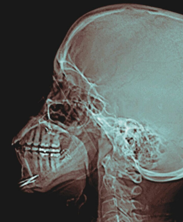 - Teknologi fjerner oss ikke fra en mer «opprinnelig» ikke-mediert tilværelse. Tvert imot, medieringens tosidighet er forutsetningen for en rekke aktiviteter og kunnskap.