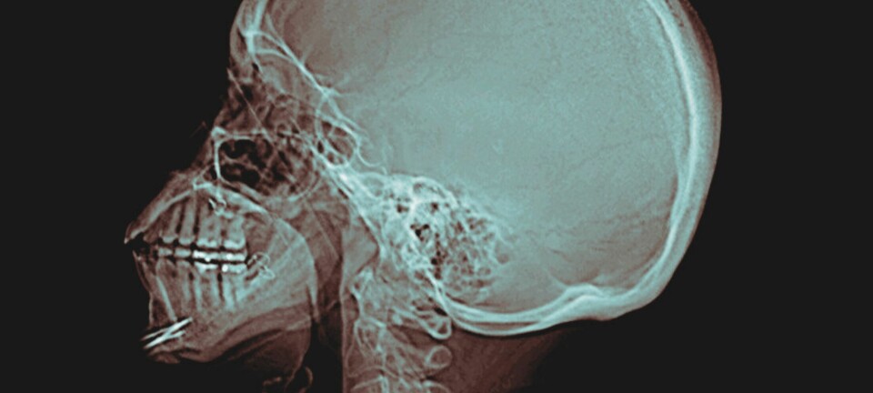 LES NESTE DEL: HVA ER «TEKNOLOGISK MEDIERING»?